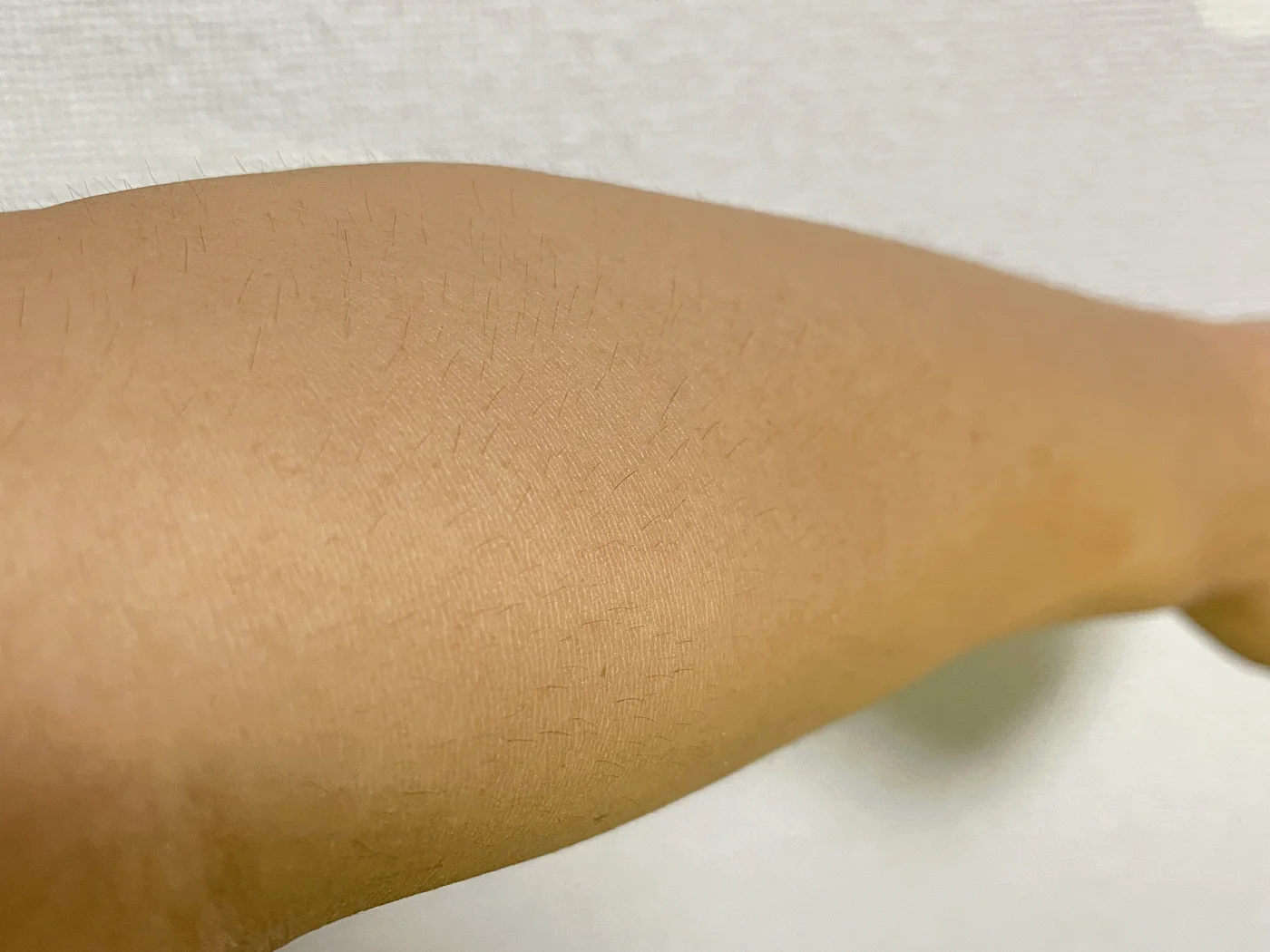 脱毛前の腕の様子