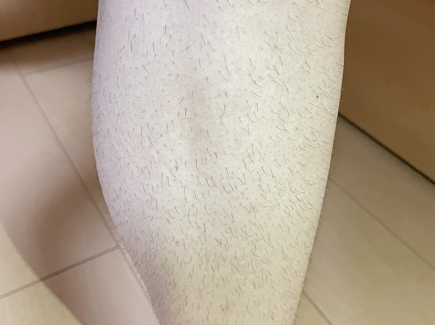 脱毛前の足の様子
