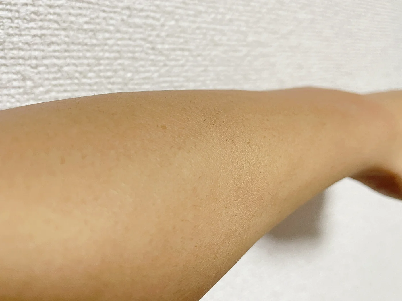 4週間経過後の腕の様子