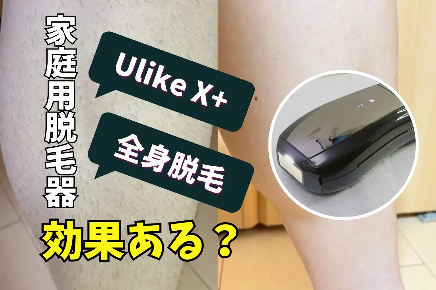 Ulikeの新製品「X+」で初めての脱毛デビュー 男でも効果ある？使ってみた感想や機能紹介！